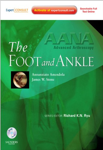 AANA Advanced Arthroscopy: The Foot and Ankle: Expert Consult: Online, Print and DVD (English Edition)