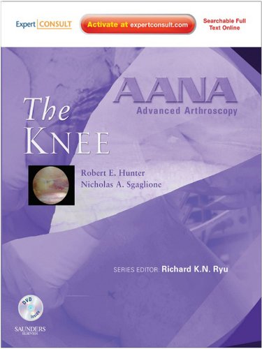 AANA Advanced Arthroscopy: The Knee: Expert Consult: Online, Print and DVD (English Edition)