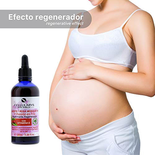 Aceite rosa mosqueta Puro 100% ecológico 100ml, prensado en frío. Para eliminar estrías y cicatrices efecto anti envejecimiento. Aceite corporal antiestrias del embarazo.