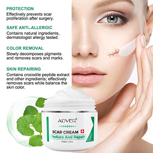 Aliver Crema de Eliminación de Cicatrices, Removedor de Estrías, Eliminación de Cicatrices de Acné Facial o Corporal, Tratamiento ee Cicatrices para Cortes, Cirugía, Quemaduras, Cortes, Queloides