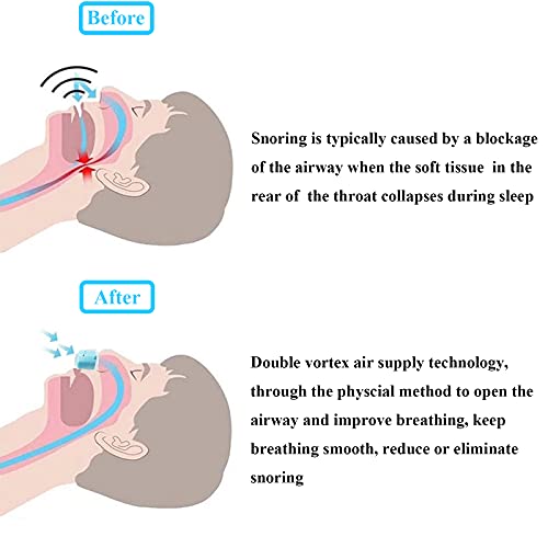 Antironquidos, 2021 Antironquidos para Dormir, Ronquidos Soluciones, Antironquidos Dilatador Nasal para No Roncar de Noche, Dejar De Roncar, Antironquidos para Dormir Eficaz