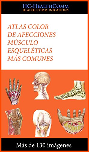 Atlas color de afecciones músculo esqueléticas más comunes: Más de 130 imágenes