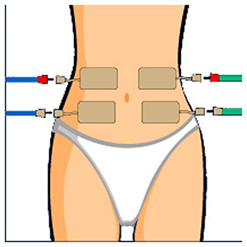 CefarCompex Cefar Compex Electrodes Stimtrode Wirep by