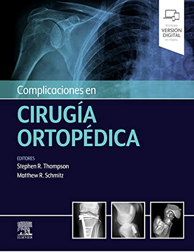 Complicaciones en cirugía ortopédica: Medicina deportiva