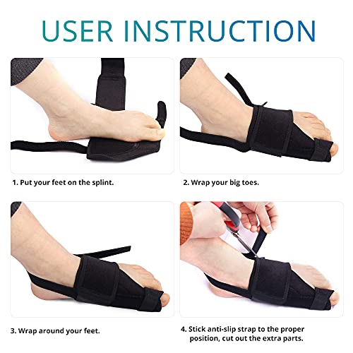 Corrector de hallux y separadores de hallux valgus, férula ortopédica de hallux valgus para aliviar el dolor de hallux y enderezar los dedos de los pies, ortesis de para soporte diurno/nocturno