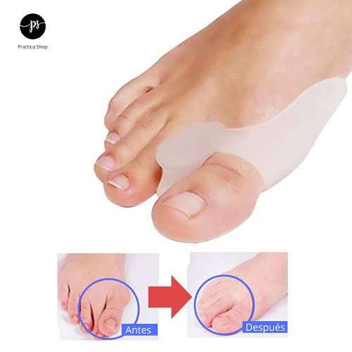 Corrector de Juanetes, de Gel de Silicona Para Dedo Gordo del Pie, Separador Hallux Valgus, Almohadilla ortopédica, Enderezadora de postura del dedo, 2 Pares 4 Unidades