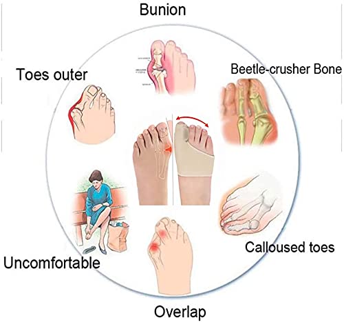 Corrector de Juanetes, Hallux Valgus Corrector Kit para Aliviar el Alisador del Dedo Gordo, Bola de Masaje de Pies para Sastres Hallux Valgus, Dedos Superpuestos, Articulación del Dedo Gordo