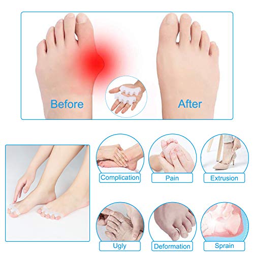 Corrector de Juanetes Separador de Dedos de Gel Corregir Hallux Valgus Alivio Dolor Del Pie para Hombres y Mujeres 9 Piezas