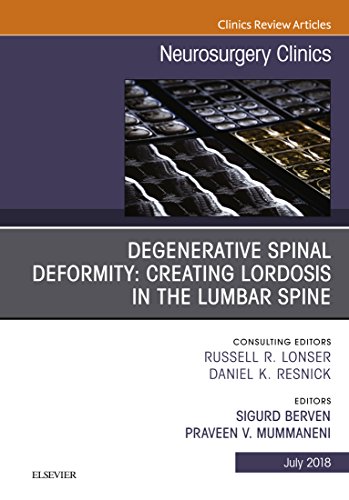 Degenerative Spinal Deformity: Creating Lordosis in the Lumbar Spine, An Issue of Neurosurgery Clinics of North America (The Clinics: Surgery) (English Edition)