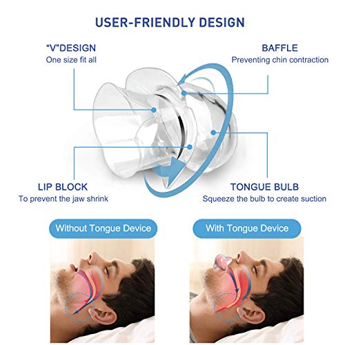 Dyroe Dispositivos Anti Ronquidos 4 in 1,8pcs Dilatador Nasal,2pcs Clips Nasales Magnéticos,Retenedor de lengua y Férula de dientes para Ayudar a Dormir Mejor,Dejar De Roncar