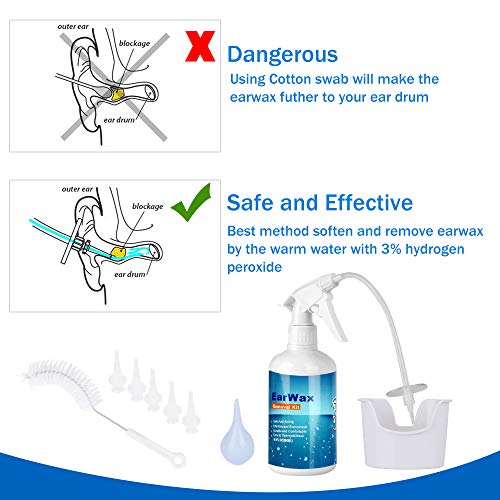 El kit de eliminación de cera en los oídos, limpiador de oídos seguro y eficaz para adultos y niños, alivio de las orejas/dolor de oído bloqueado/prurito, mejorando su audición