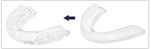 El mejor Férula anti ronquidos Solutions ZZZ [2 PCS] GRATIS: Se envía el ebook a petición del interesado + caja para - Férula dental confortable - Una alternativa para la dilatadores nasales