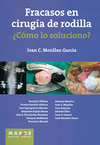 Fracasos en cirugía de rodilla ¿Cómo lo soluciono?: 0 (Marge Medica Books)