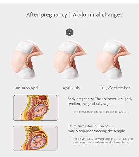 GONGMICF Fajas De Embarazo para Premamá para Espalda, Pelvis, Caderas, Abdominales, Disfunción El Pubis De La Sínfisis para Reducir Dolores De Espalda Y Abdominales XXL