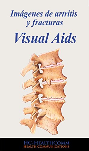 Imágenes de artritis y fracturas, Visual Aids: Full Ilustrado