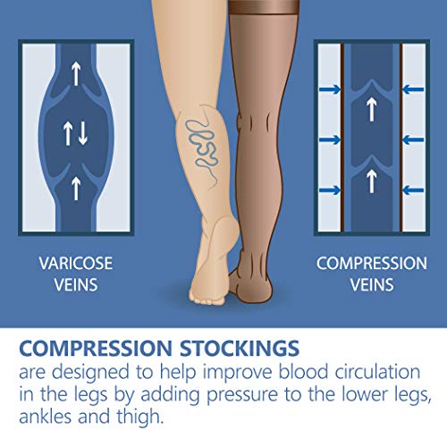 Medias de muslo con punta abierta 2 grado médico 23-32 mmHG compresión MEDICIONES X-Small Beige