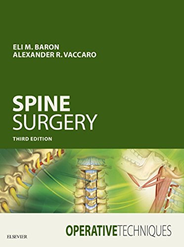 Operative Techniques: Spine Surgery E-Book: Expert Consult - Online and Print (English Edition)