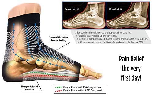 Orthosleeve media compresión graduada FS6, Beige, talla L. 6 zonas de compresión. Producto específico para fascitis plantar y dolor en el talón, Mejora la circulación, Reduce la inflamación