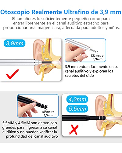 Otoscopio Digital WiFi-OVIFM 3,9mm HD Endoscopio Oido con 6 LED y Caja de Almacenamiento, Camara Endoscopica Inalámbrico con Herramienta de Limpieza de Oidos, Soporte para Movil，IPhone y Android