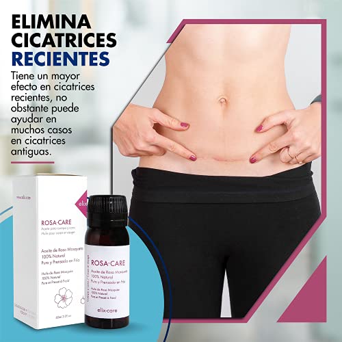 Pack Cicatrices - Parche Reductor de Cicatrices con Ácido Hialurónico + Rosa Mosqueta 100% Natural - Ideal cicatrices y queloides: cesárea, cirugías estéticas, quemaduras - Adultos y Niños