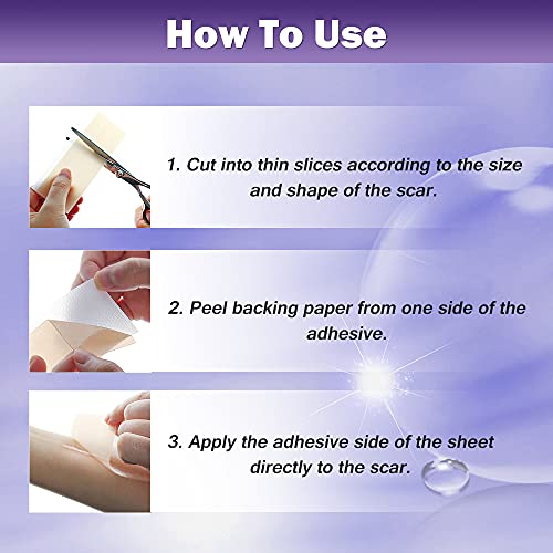 Parches Cicatrices, Hojas de Cicatriz de Silicona, reduce la visibilidad de las cicatrices, hace que las cicatrices sean permanentemente más planas, brillantes y suaves - 4 piezas
