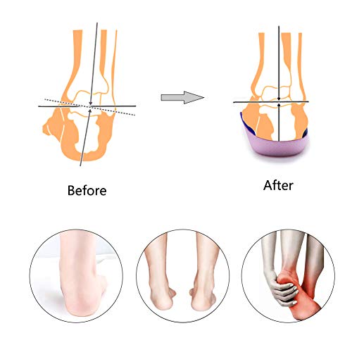 PCSsole 3/4 Plantillas de calzado ortopédico Soportes de arco alto Plantillas de zapatos para la fascitis plantar,Pie plano, Sobre-pronación,Alivio del dolor del talón (EU-(43-46))