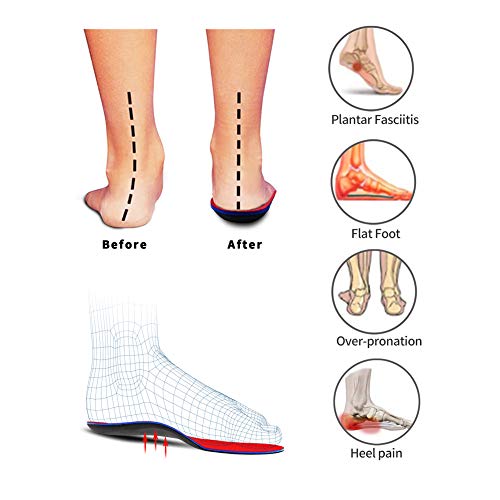 PCSsole Orthotic Arch Support Inserciones de calzado Plantillas para pies planos, dolor en los pies, fascitis plantar, plantillas para hombres y mujeres (EU43-44(28cm))