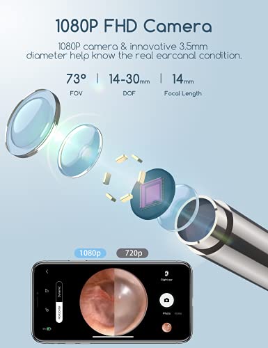 QIMIC Otoscopio 3,5mm WiFi Endoscopio con 6 LED Camara Endoscopica Inalámbrico, Kit de Limpieza de Oídos para Eliminación de Cerumen para iPhone, Tabletas y Android