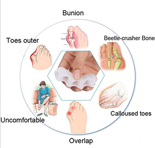 Separador del dedo del pie, dedo del pie Cinco dispositivo de corrección valgus, dedo cuidado for proteger y aliviar dedos de los pies superpuestos, 2 Toe Camilla for actividades interiores y exterior