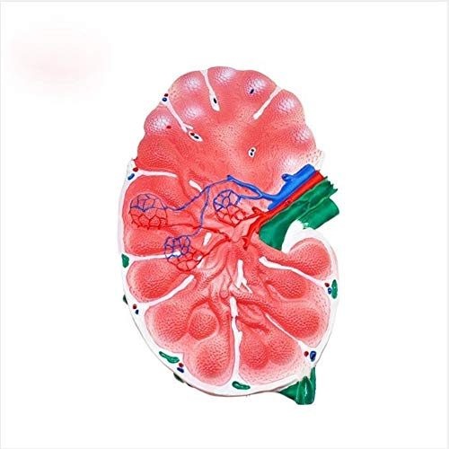 .ShuYing 1pc Lymphonodus Lupa Modelo Humano Realista Órgano Lupa Linfoide Modelo Biología Enseñanza Ciencia Educación Instrumento