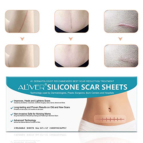 Silicone Scar Removal Sheets, Fast & Effective Removes Scars for C-Sections, Acne, Surgery, Burn and More, Reusable Scar Strips [5.9”x1.57”] - 4 Pack (2 Month Supply)