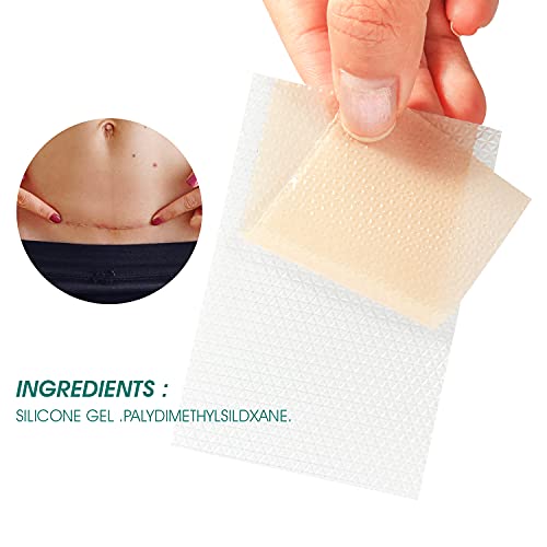 Silicone Scar Sheets, Sábanas de Cicatriz, Parche de cicatrices, Reducción de Cicatrices, Tratamientos de Reducir Cicatrices para Acné, Cirugía, Cicatrices de Quemaduras - 4pcs