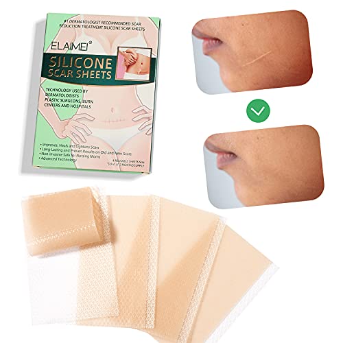 Silicone Scar Sheets, Sábanas de Cicatriz, Parche de cicatrices, Reducción de Cicatrices, Tratamientos de Reducir Cicatrices para Acné, Cirugía, Cicatrices de Quemaduras - 4pcs