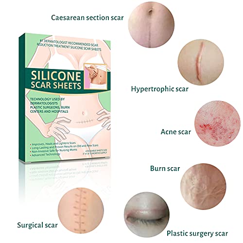 Silicone Scar Sheets, Sábanas de Cicatriz, Parche de cicatrices, Reducción de Cicatrices, Tratamientos de Reducir Cicatrices para Acné, Cirugía, Cicatrices de Quemaduras - 4pcs