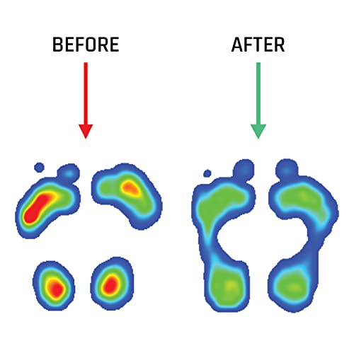 SMOU META Plantillas para metatarsalgia | Alivian el dolor de almohadilla metatarsal con barra retrocapital | Plantillas gel y memory foam gran amortiguación | Ortopédicas mujer o hombre (35-36 EU)