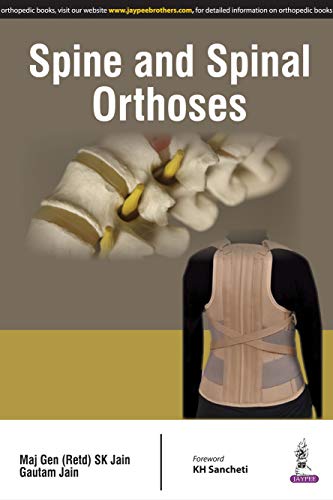 Spine and Spinal Orthoses (English Edition)