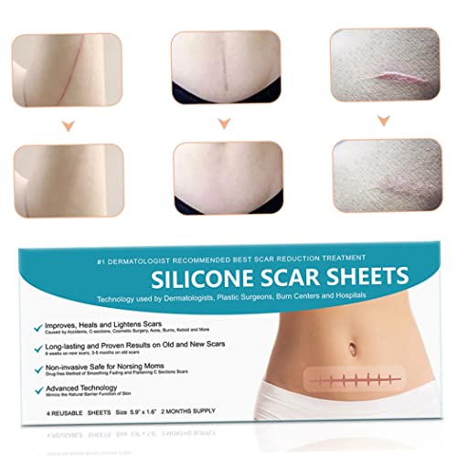 Sraeriot Silicone Scar Removal Shoets Aplatantes Suaviza Las Hojas De Cicatrices Removedor De Cicatriz Resultante De Las Tiras De La Cicatriz De La Cirugía 4pcs, Parches De Reparación De Cicatrices