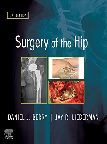 Surgery of the Hip E-Book: Expert Consult - Online and Print (English Edition)