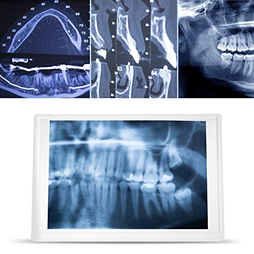 Tarente Negatoscopio, Plug AC110-220V UE película Dental Visor Ver Viewbox Box LED con el Soporte del Chip de la Abrazadera