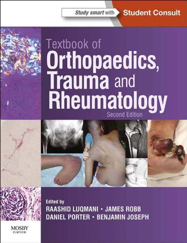 Textbook of Orthopaedics, Trauma and Rheumatology E-Book (English Edition)