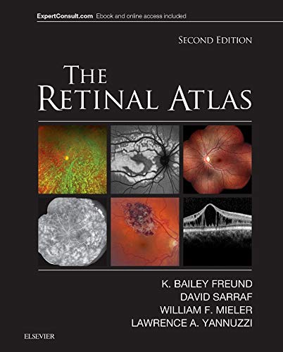 The Retinal Atlas, 2e: Expert Consult - Online and Print