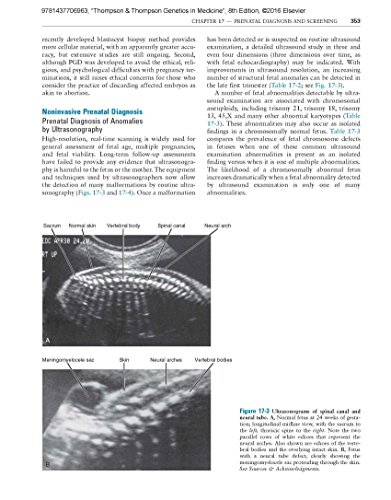 Thompson & Thompson Genetics in Medicine, 8e (Thompson and Thompson Genetics in Medicine)