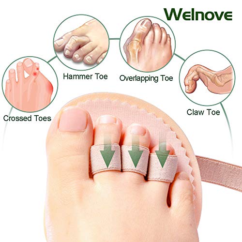 Welnove Corrector Dedos Plantillas de Los Pies, Separador Dedos Pies, Protector Plantar del Callo para Alivio Juanetes, Martillo, Dedo Garra, 2 uds 3 Agujeros Metatarso Almohadilla Pies