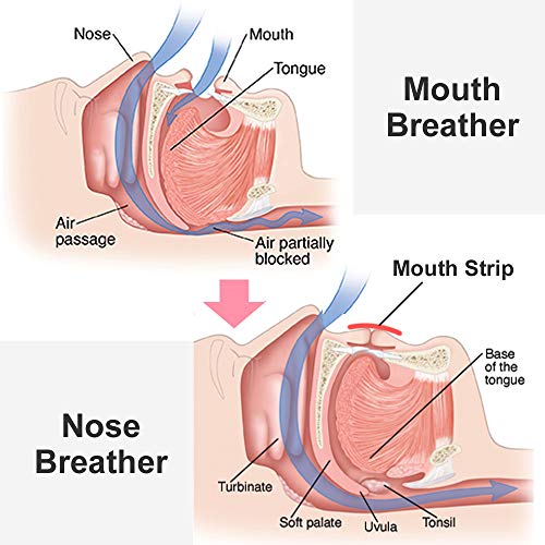 WoodyKnows Cinta bucal, tiras bucales antirronquidos, desarrolla el hábito de la respiración nasal, mantiene la forma natural de la cara (Fuerza Media, Modelo Original, 24 Piezas)