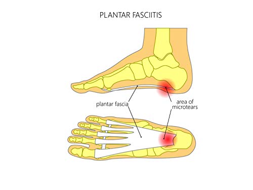 ActivSocks Calcetines de Compresión Graduada | Tratamiento para Fascitis Plantar de Aquiles | Medias Terapéuticas | Ideal por Deportivos e Caminar PAR