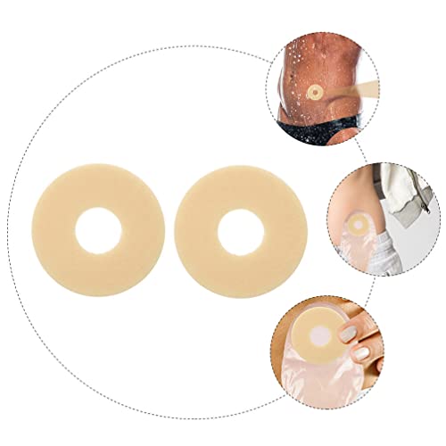 Anillo de barrera de ostomía elástica moldeable: anillos de extensión de piel hidrocoloide suministros de ostomía 2 piezas