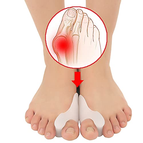 Corrector contra hallux valgus o onión con pie ortesis correctiva gel flexible de silicona