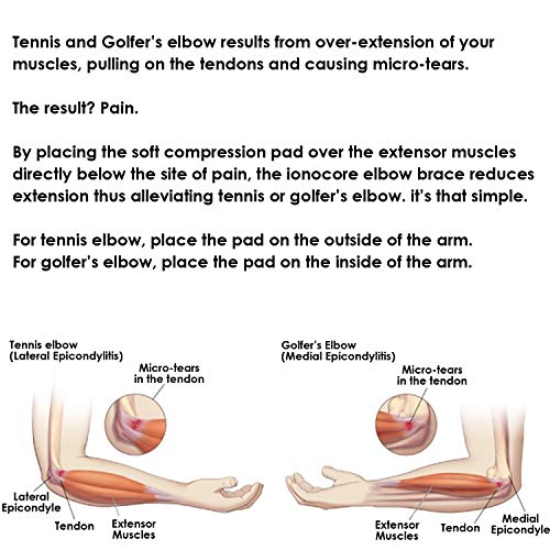 Ionocore® Correa de Apoyo para el Codo de Tenista | Brazelete para Golfistas con Almohadilla de Compression Dirigida y Cierre Ajustable | Banda de soporte para las Articulaciones del Codo