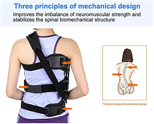 jjff Corrector De Postura para Escoliosis, Órtesis Auxiliar Espinal Ajustable, para Hombres Y Mujeres Adultos Fijación Postoperatoria De Escoliosis.