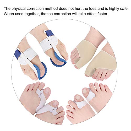 Juego de correctores de Hallux Valgus, 4 en Hallux Valgus / Articulación del dedo gordo del pie / Martillo para piernas y pies / Tratamiento quirúrgico de férula de bola